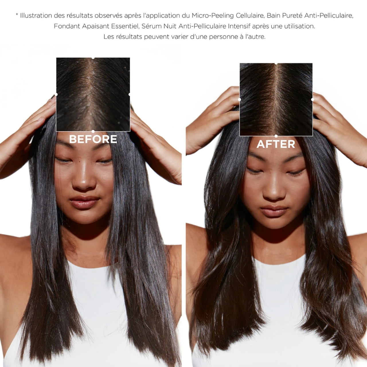 Sérum Cellulaire Nuit Anti-Pelliculaire Intensif Symbiose Kérastase Sérum Cellulaire Nuit Anti-Pelliculaire Intensif Symbiose Kérastase -Capillaires Produits Boutique Sans titre 350 350 px 500 500 px 280 280 px 140 140 px 350 350 px 1200 1200 px 19 31693.1684847701