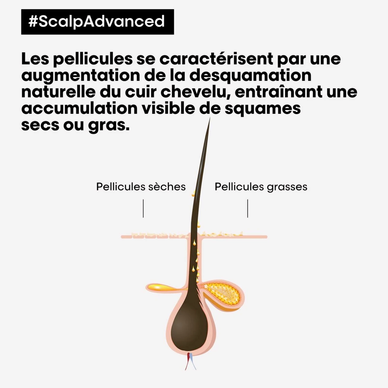 Shampooing Anti-Pelliculaire Scalp Advanced L'Oréal 500ml Shampooing Anti-Pelliculaire Scalp Advanced L'Oréal 500ml -Capillaires Produits Boutique scalp 93191.1684847788